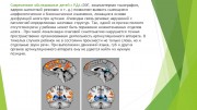 Развитие артикуляции у детей с расстройством аутистического спектра